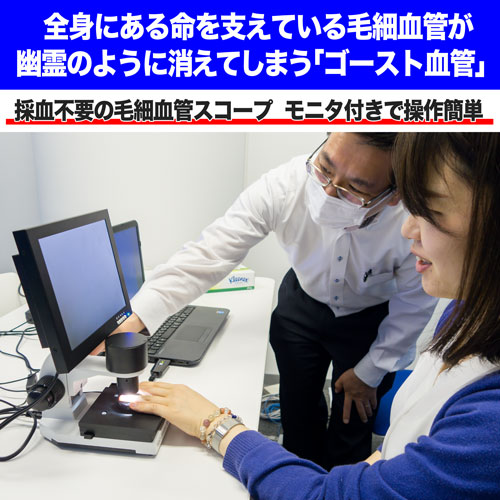 血流スコープで血流観察